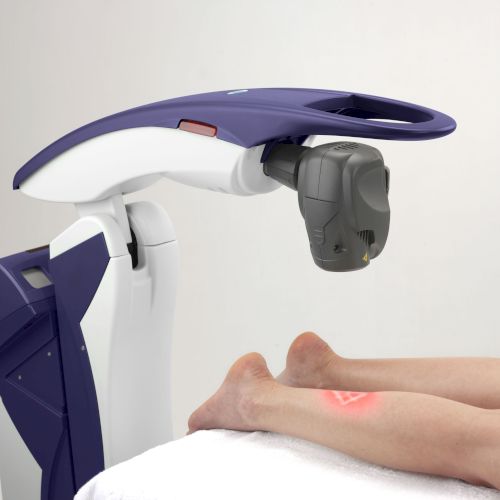 The image shows a medical device positioned over a patient's legs, possibly for a laser or diagnostic procedure.