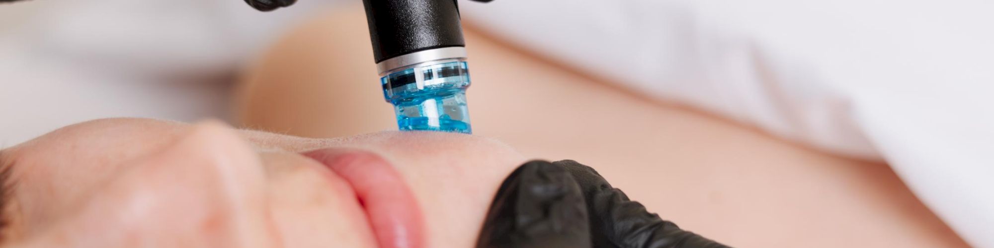 A beauty professional uses a handheld device on a client&rsquo;s face during a facial treatment, wearing black gloves and a calm, relaxing setting.